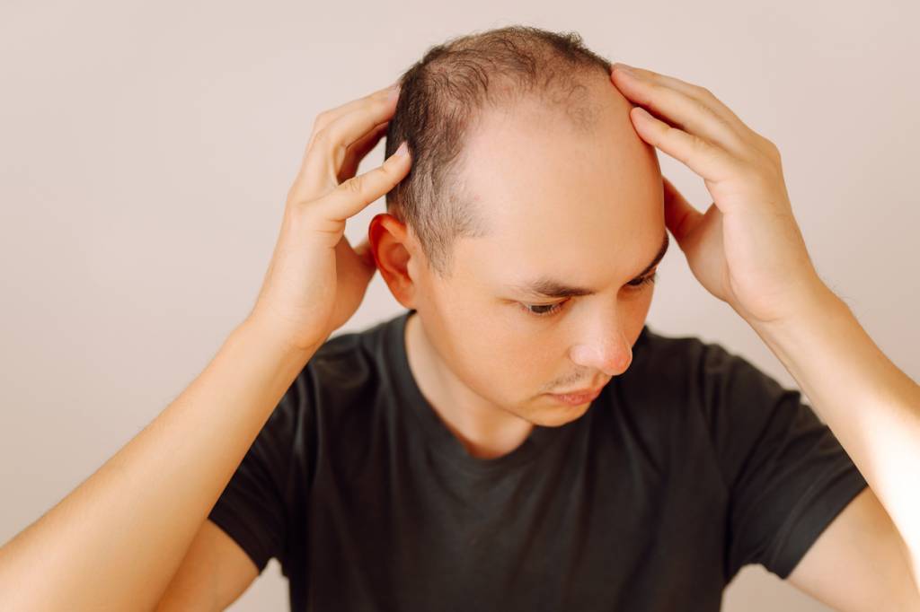 Solutions pour combattre perte cheveux